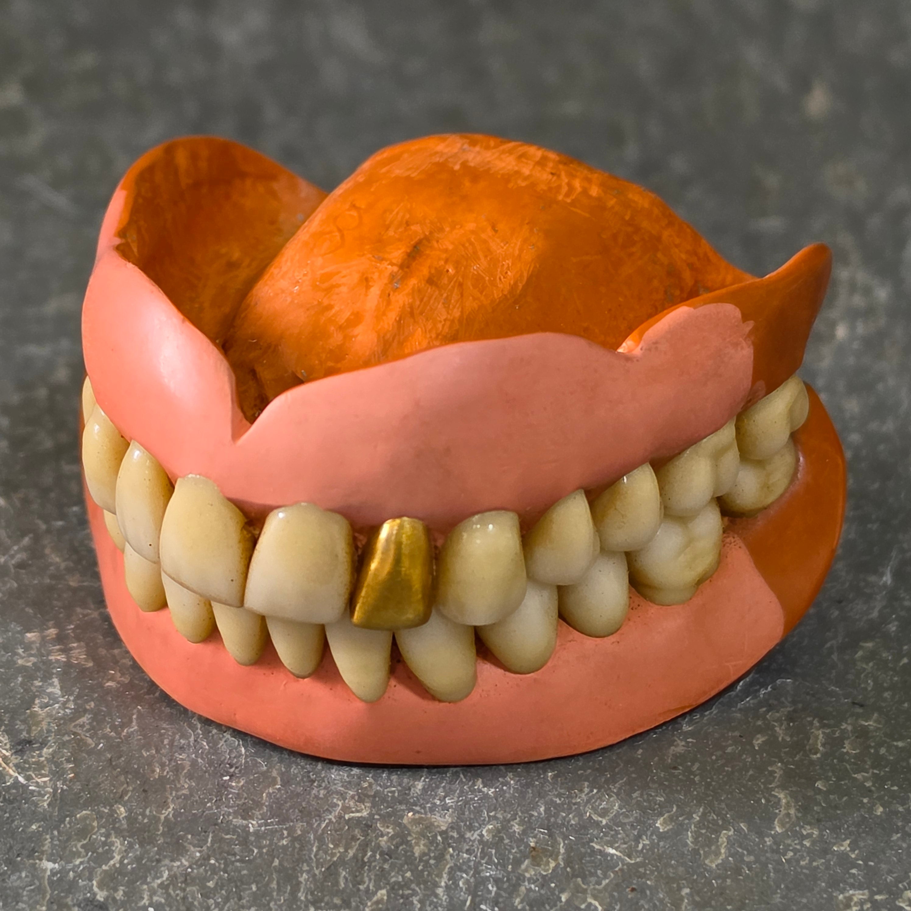 Vintage Mid Century Full Set Dentures Gold Tooth Crown Oddity Medical Display
