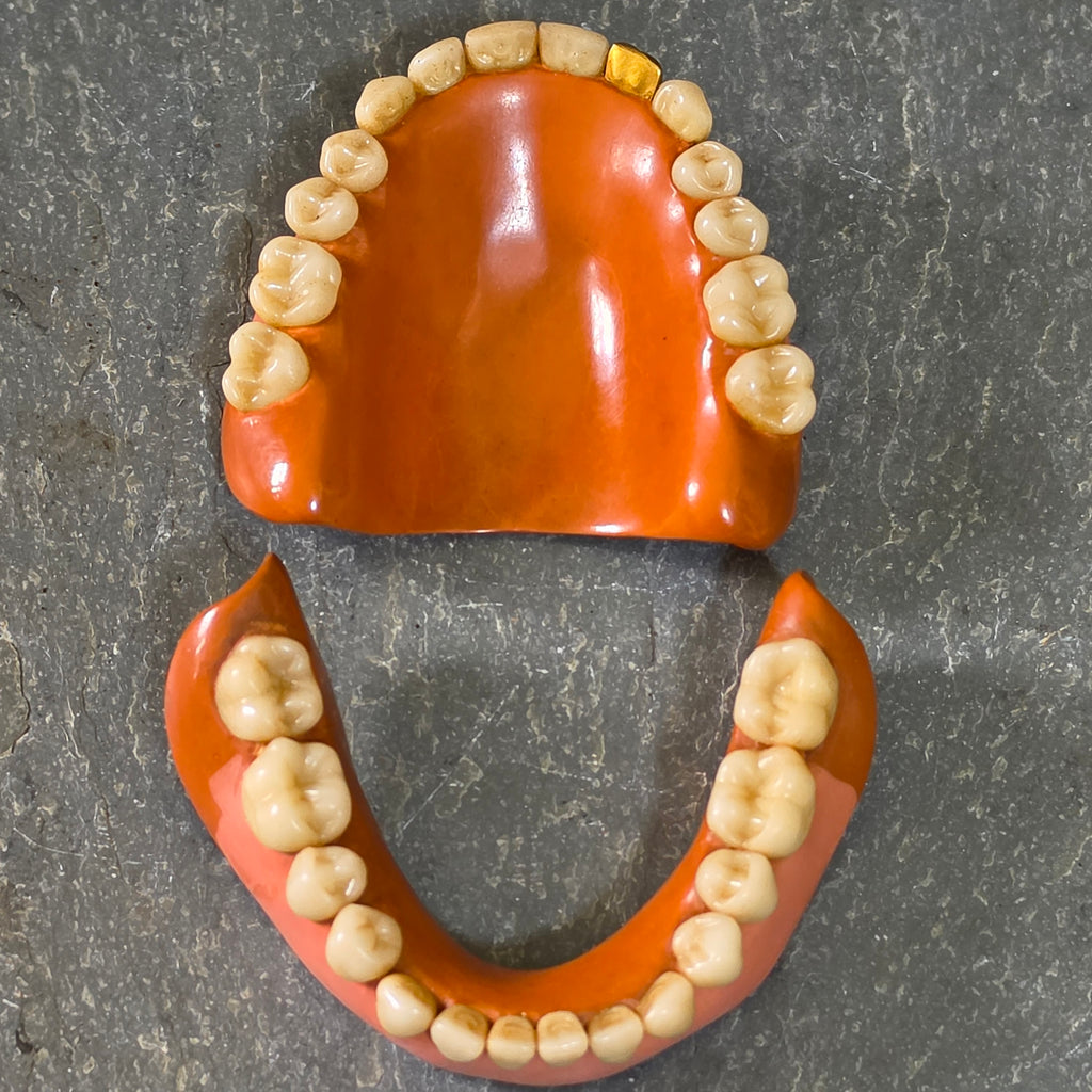 Vintage Mid Century Full Set Dentures Gold Tooth Crown Oddity Medical Display