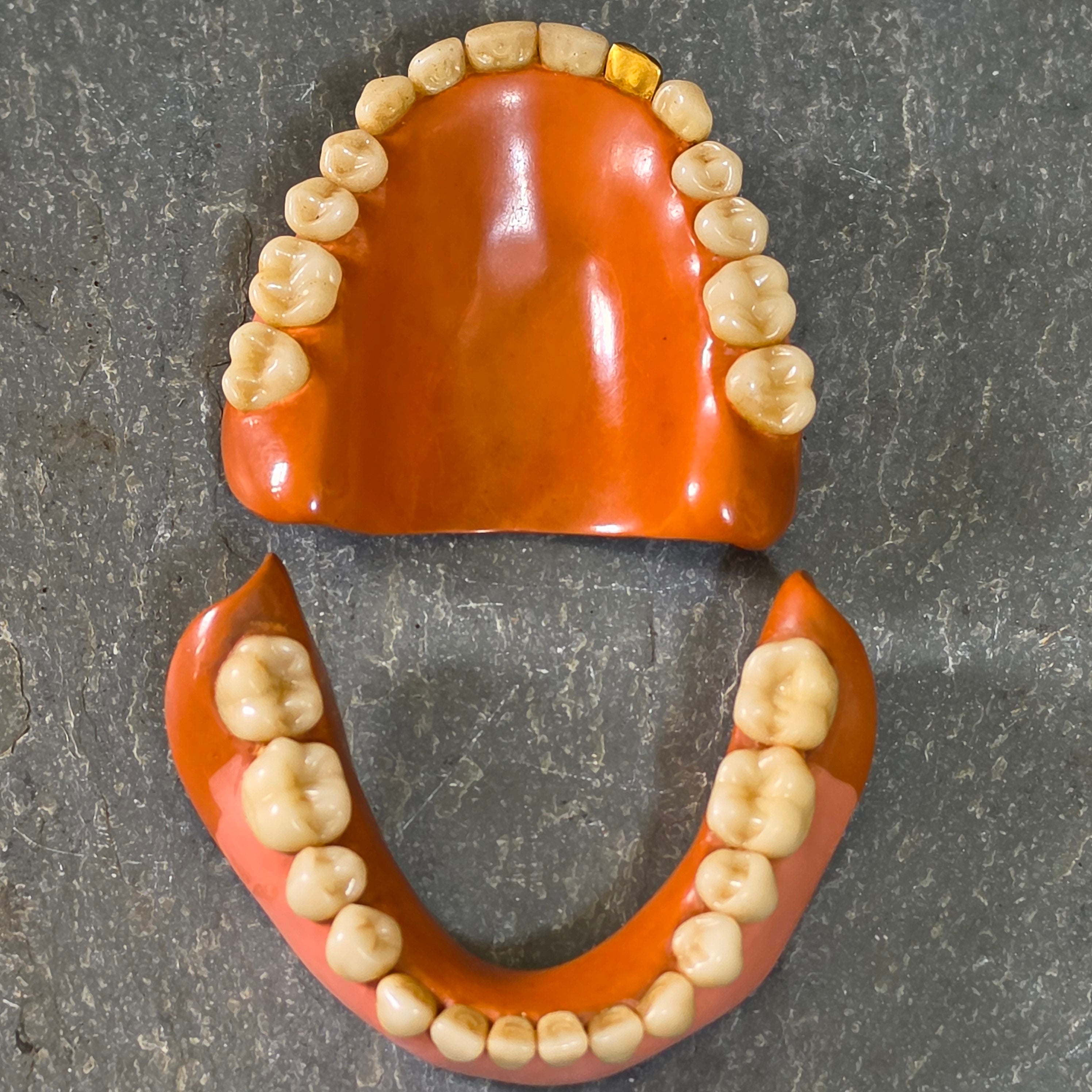 Vintage Mid Century Full Set Dentures Gold Tooth Crown Oddity Medical Display