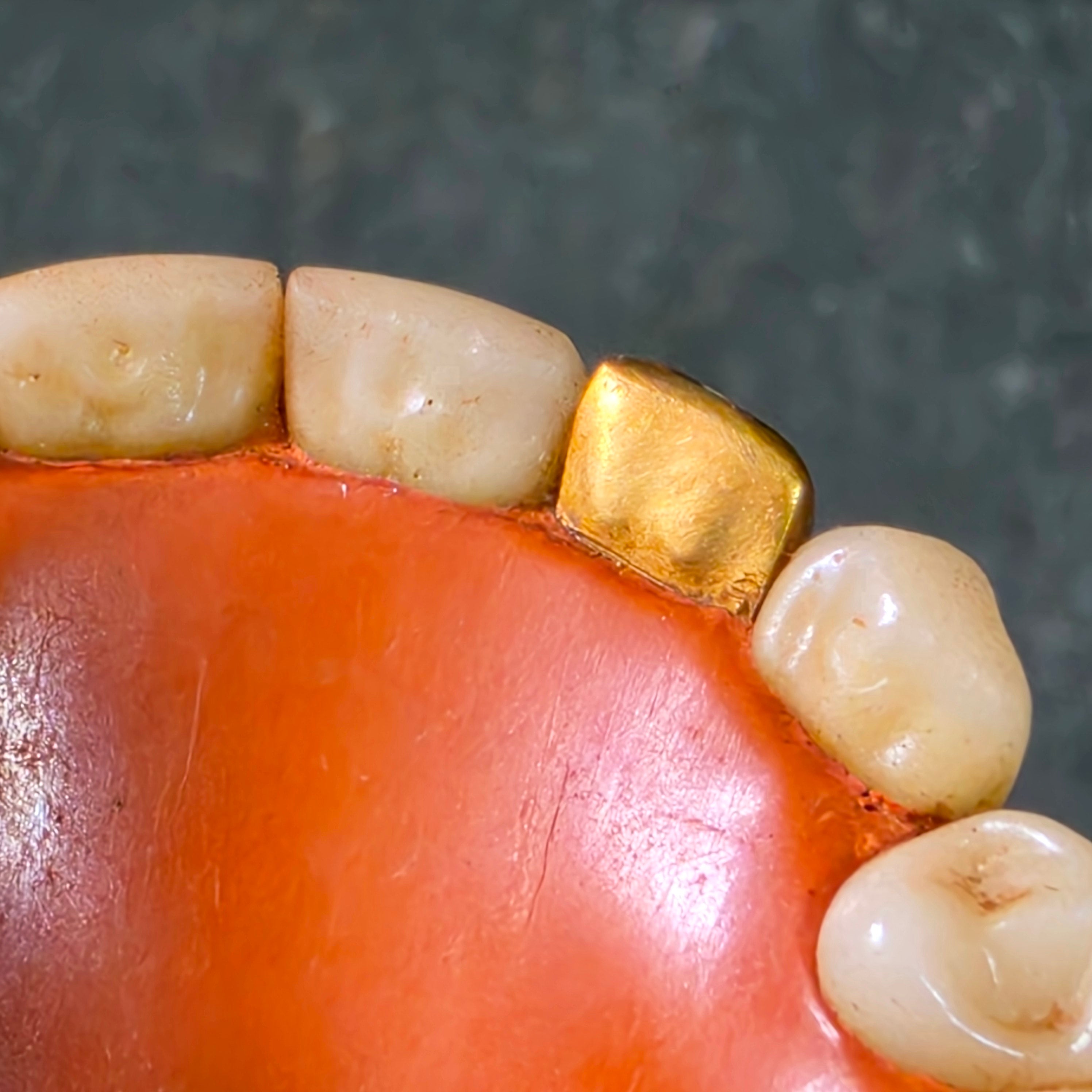 Vintage Mid Century Full Set Dentures Gold Tooth Crown Oddity Medical Display