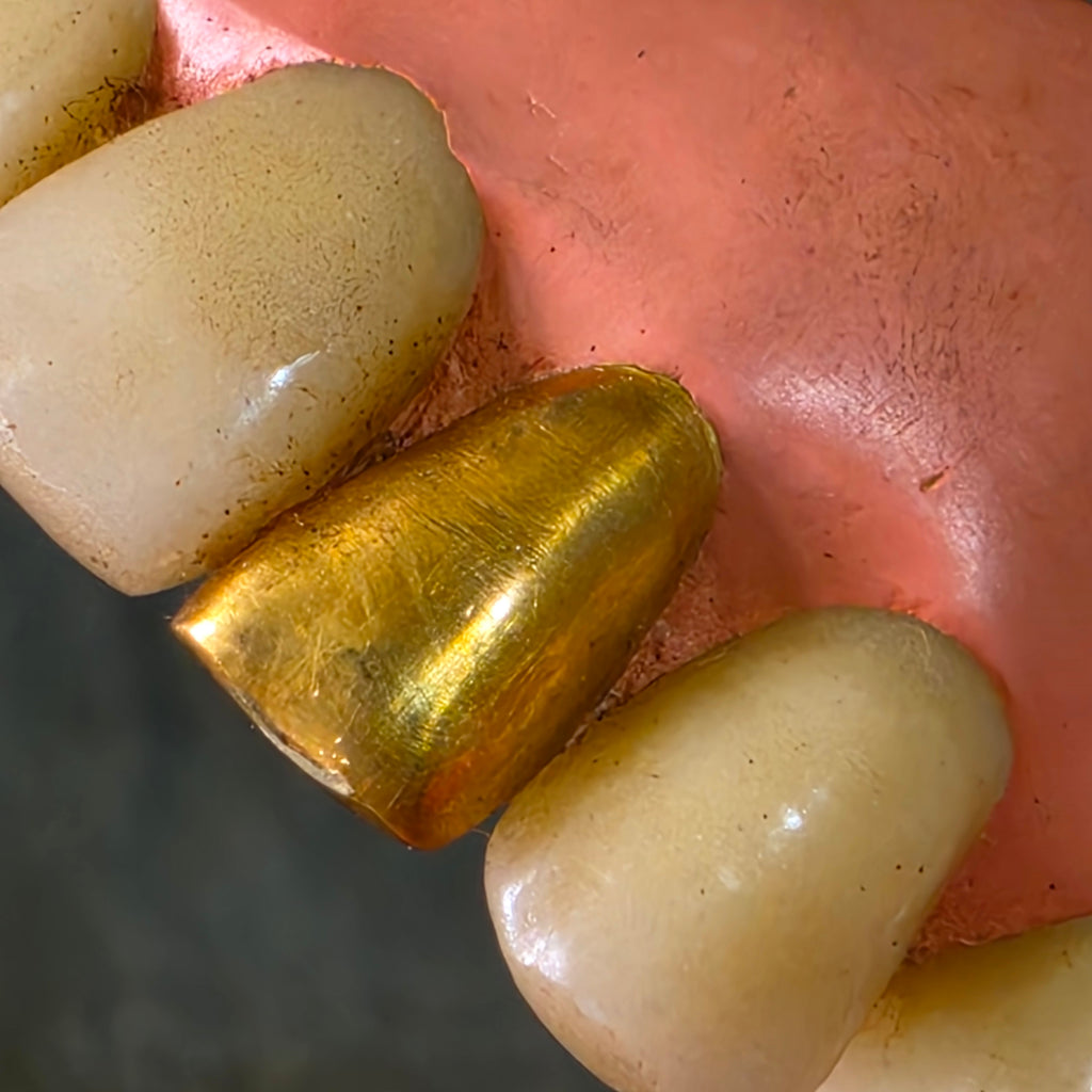 Vintage Mid Century Full Set Dentures Gold Tooth Crown Oddity Medical Display